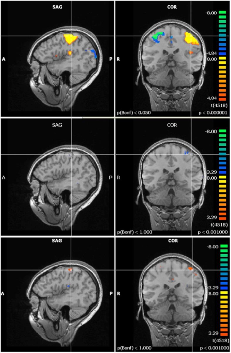 https://cdn.ncbi.nlm.nih.gov/pmc/blobs/47e1/4516358/21e62e2777ae/pone.0132024.g007.jpg