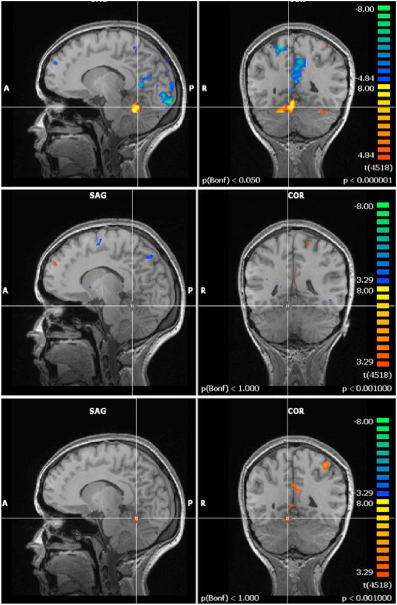 https://cdn.ncbi.nlm.nih.gov/pmc/blobs/47e1/4516358/af41537e508e/pone.0132024.g008.jpg