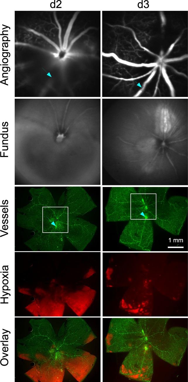 https://cdn.ncbi.nlm.nih.gov/pmc/blobs/47e2/5846732/f0e09e2ea63c/pone.0191338.g001.jpg