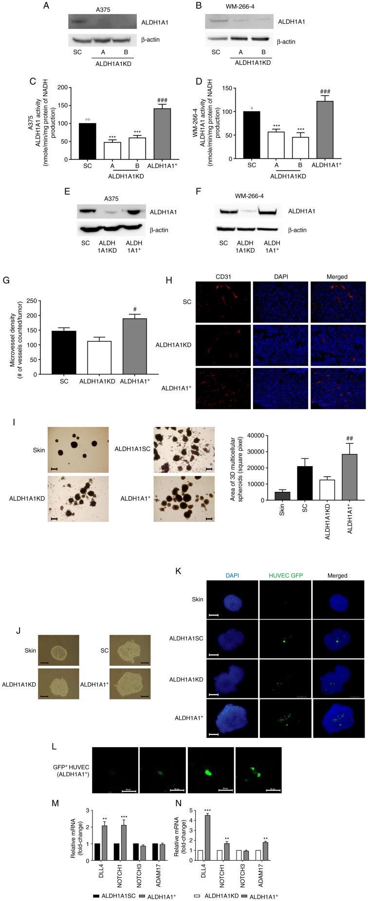 https://cdn.ncbi.nlm.nih.gov/pmc/blobs/47e6/9186295/3c001a47faa8/IJMM-50-01-05155-g00.jpg