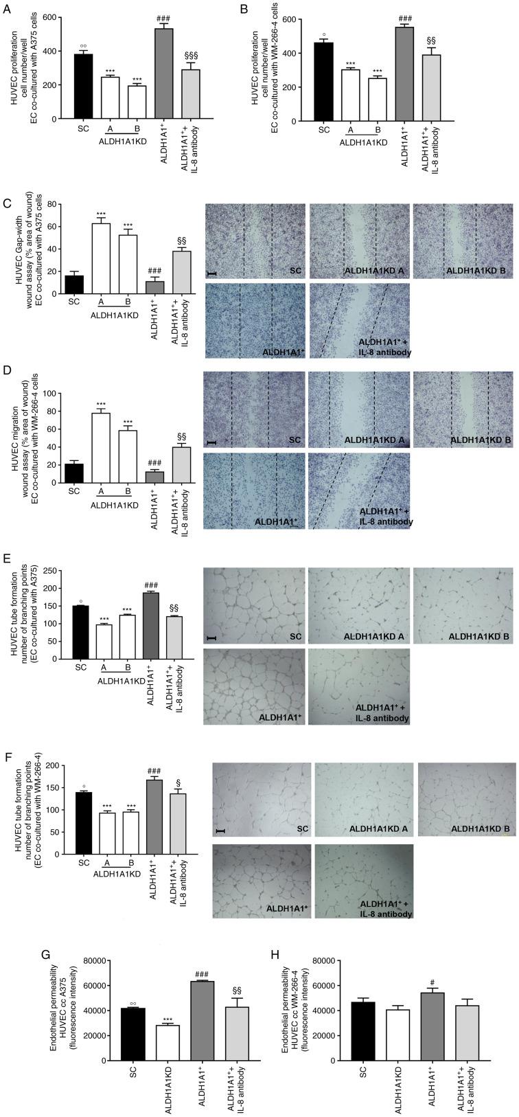 https://cdn.ncbi.nlm.nih.gov/pmc/blobs/47e6/9186295/45cfefdb41bc/IJMM-50-01-05155-g02.jpg