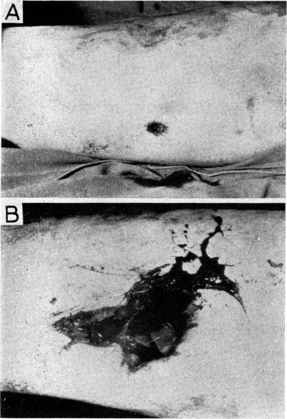 https://cdn.ncbi.nlm.nih.gov/pmc/blobs/4801/1644834/63ca79190551/procrsmed00336-0100-a.jpg