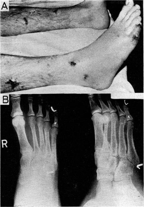 https://cdn.ncbi.nlm.nih.gov/pmc/blobs/4801/1644834/d35967637b6f/procrsmed00336-0099-b.jpg