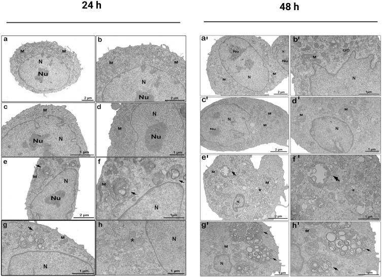 https://cdn.ncbi.nlm.nih.gov/pmc/blobs/4807/12049682/2490a37d93a7/IJN-20-5573-g0003.jpg