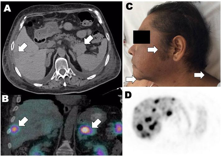 https://cdn.ncbi.nlm.nih.gov/pmc/blobs/4808/7438413/546cee0a8e76/fendo-11-00557-g0001.jpg
