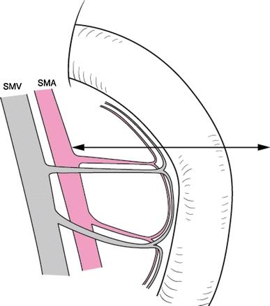 https://cdn.ncbi.nlm.nih.gov/pmc/blobs/480b/3311854/b351f4797bbf/534_2011_480_Fig5_HTML.jpg