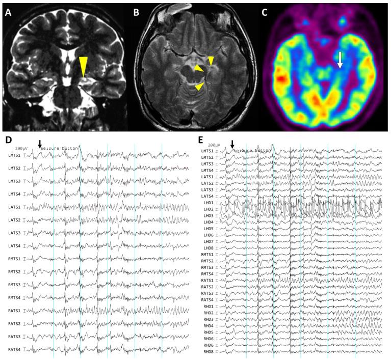 https://cdn.ncbi.nlm.nih.gov/pmc/blobs/480c/10669380/db8c610524e8/brainsci-13-01547-g003.jpg