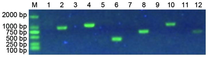 https://cdn.ncbi.nlm.nih.gov/pmc/blobs/4811/5865821/305e5281ea1d/mmr-16-05-6526-g01.jpg