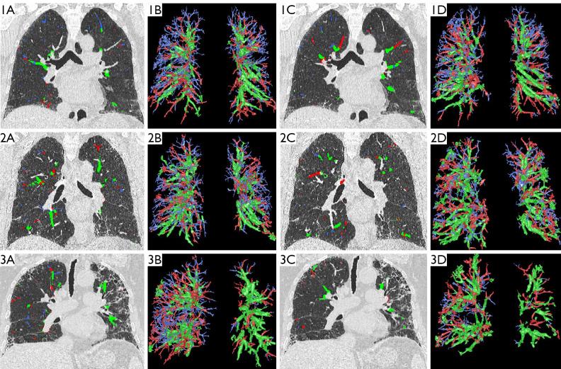 https://cdn.ncbi.nlm.nih.gov/pmc/blobs/4816/11994571/964562257088/qims-15-04-3333-f2.jpg