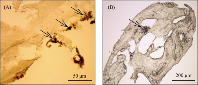 https://cdn.ncbi.nlm.nih.gov/pmc/blobs/4817/6920466/e7c1adce7857/41598_2019_55810_Fig3_HTML.jpg