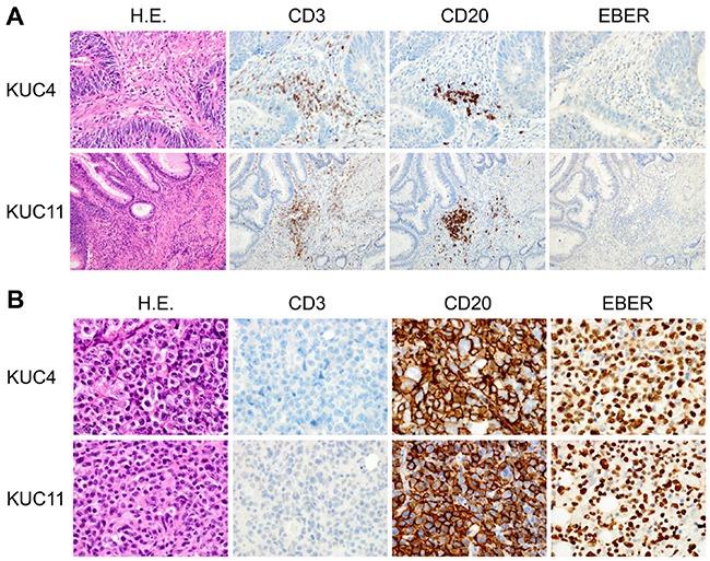 https://cdn.ncbi.nlm.nih.gov/pmc/blobs/481c/5226574/80c48bce03ec/oncotarget-07-50150-g001.jpg