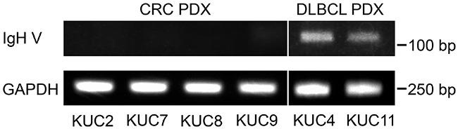 https://cdn.ncbi.nlm.nih.gov/pmc/blobs/481c/5226574/d7de41dcbf1b/oncotarget-07-50150-g004.jpg