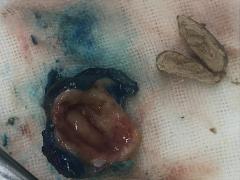 https://cdn.ncbi.nlm.nih.gov/pmc/blobs/481e/5709007/45db192f4544/medi-96-e8872-g003.jpg