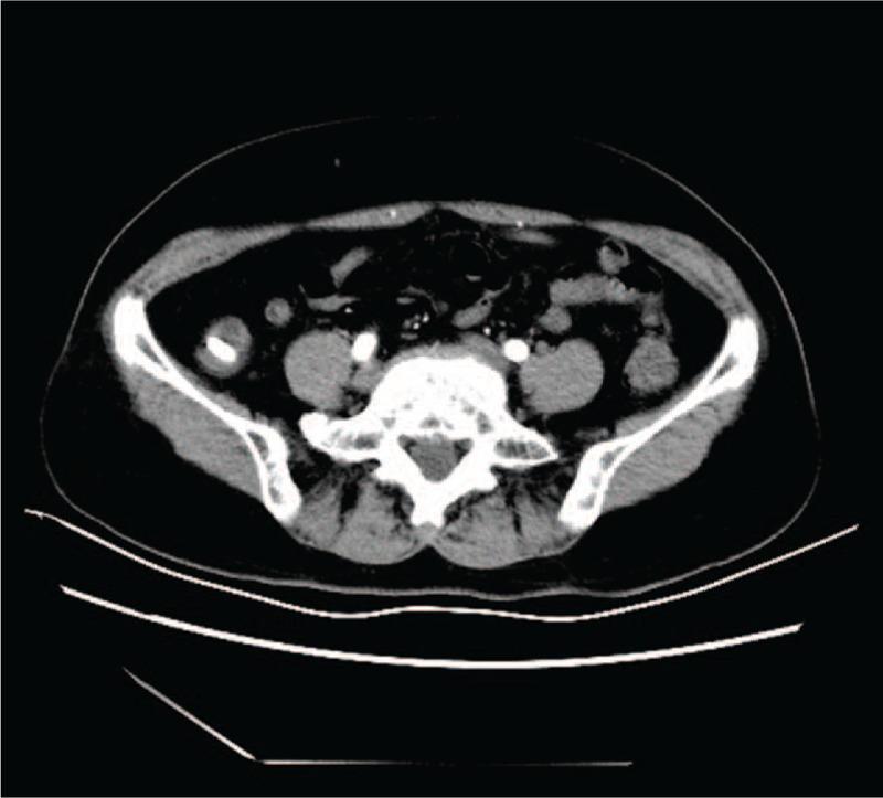 https://cdn.ncbi.nlm.nih.gov/pmc/blobs/481e/5709007/acf2e66c8492/medi-96-e8872-g001.jpg
