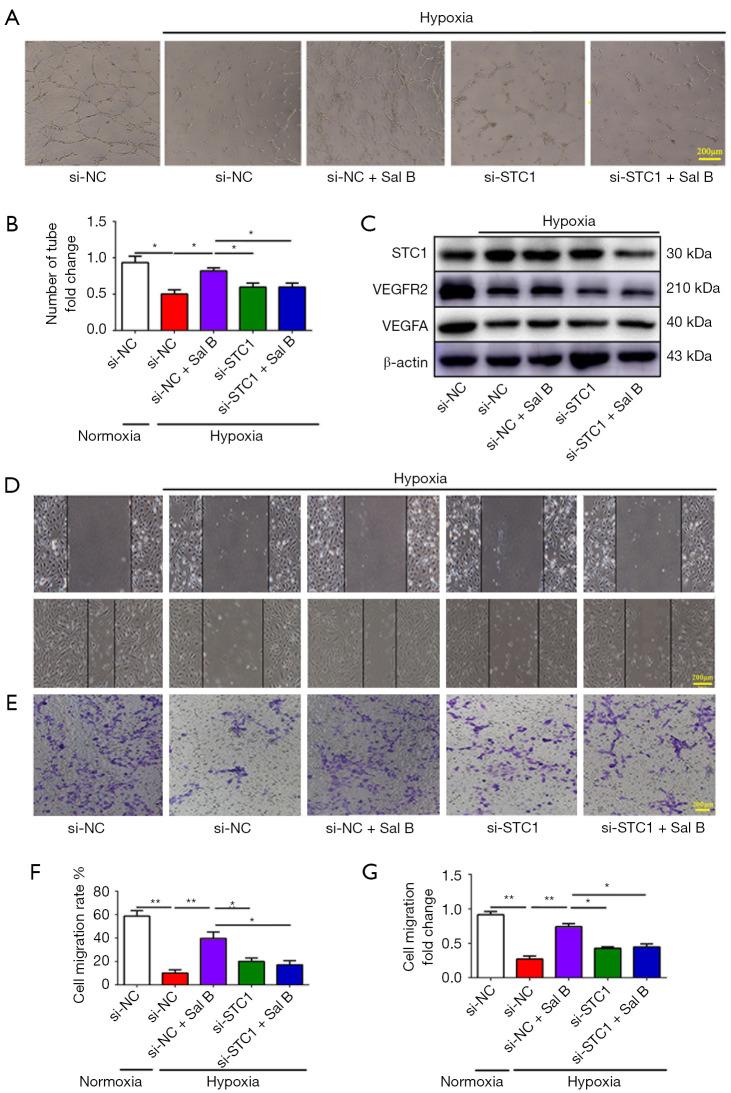https://cdn.ncbi.nlm.nih.gov/pmc/blobs/481f/9358494/3986e79d953f/atm-10-13-739-f6.jpg