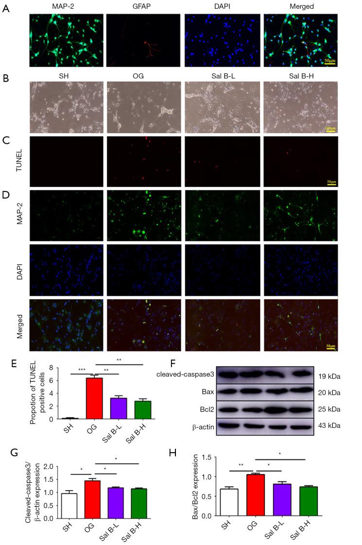 https://cdn.ncbi.nlm.nih.gov/pmc/blobs/481f/9358494/7cfeaf75b1fc/atm-10-13-739-f3.jpg