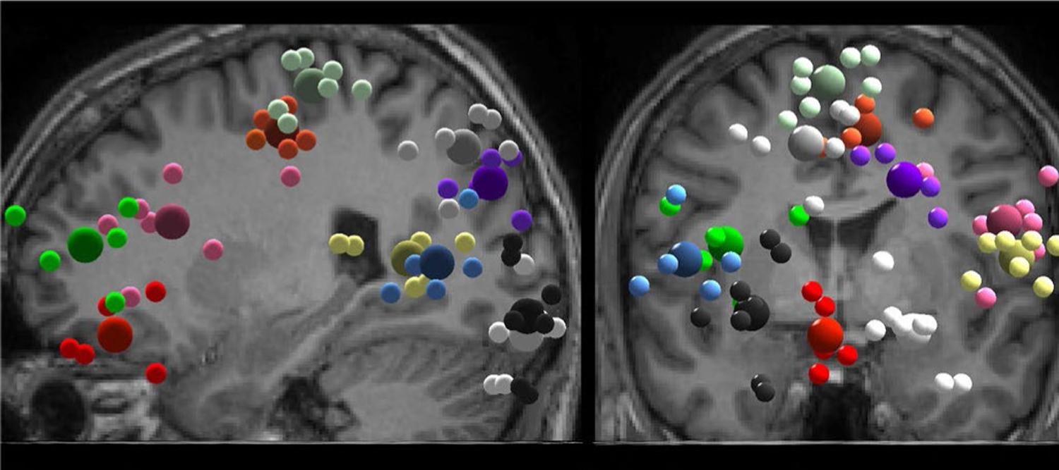 https://cdn.ncbi.nlm.nih.gov/pmc/blobs/4820/10616968/565f86c1b010/nihms-1934488-f0003.jpg