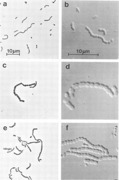 https://cdn.ncbi.nlm.nih.gov/pmc/blobs/4823/347730/6af3e5da782a/iai00145-0295-a.jpg