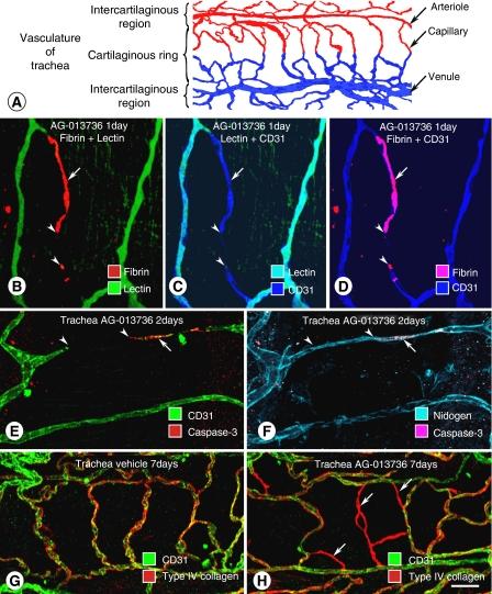 https://cdn.ncbi.nlm.nih.gov/pmc/blobs/4824/2359962/ac3e0f8ae4c5/6603813f1.jpg
