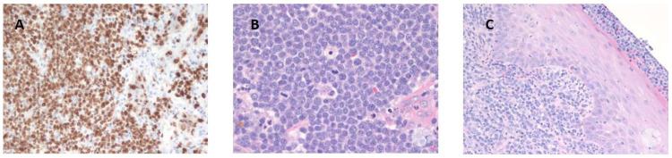 https://cdn.ncbi.nlm.nih.gov/pmc/blobs/4825/11853186/246e526a5ac3/cancers-17-00696-g002.jpg