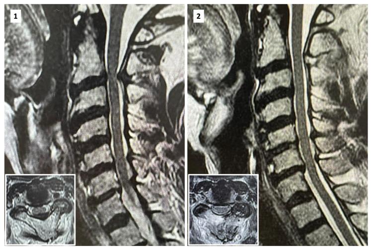 https://cdn.ncbi.nlm.nih.gov/pmc/blobs/4829/10608411/b8b88e4644ae/jpm-13-01508-g004.jpg