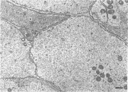 https://cdn.ncbi.nlm.nih.gov/pmc/blobs/482b/1350453/d090914e6800/jphysiol00958-0065-b.jpg