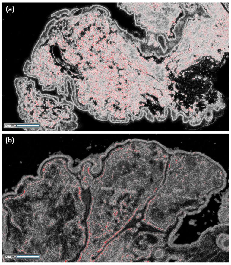https://cdn.ncbi.nlm.nih.gov/pmc/blobs/482c/10378276/6b4fa1939d4b/curroncol-30-00452-g004.jpg