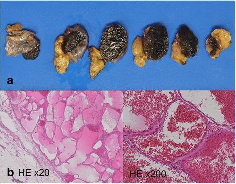 https://cdn.ncbi.nlm.nih.gov/pmc/blobs/482e/4749515/57f5142d3aa8/40792_2016_137_Fig3_HTML.jpg