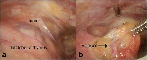 https://cdn.ncbi.nlm.nih.gov/pmc/blobs/482e/4749515/7907b1824cf2/40792_2016_137_Fig2_HTML.jpg