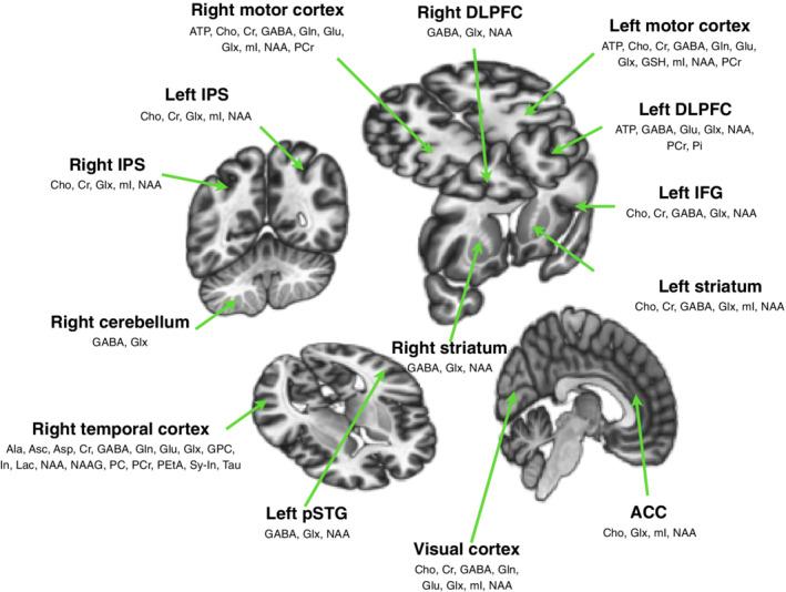 https://cdn.ncbi.nlm.nih.gov/pmc/blobs/4830/8090777/345d612db44f/HBM-42-2642-g005.jpg