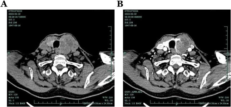 https://cdn.ncbi.nlm.nih.gov/pmc/blobs/4833/11128507/1d6c91f3ca21/gr2.jpg