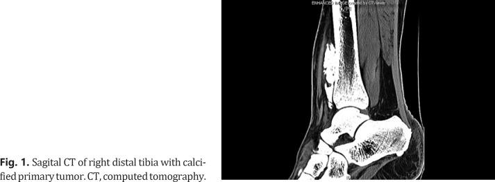 https://cdn.ncbi.nlm.nih.gov/pmc/blobs/4835/8220893/bba87143ccc2/cro-0014-0983-g01.jpg