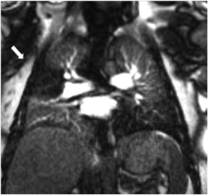 https://cdn.ncbi.nlm.nih.gov/pmc/blobs/4836/12254125/a14b6737e2da/tzaf005f9.jpg