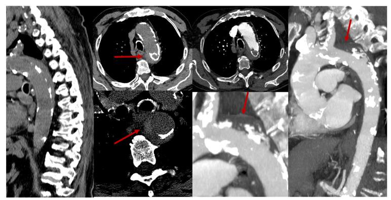 https://cdn.ncbi.nlm.nih.gov/pmc/blobs/4838/11856212/6621790b9514/jcm-14-01293-g007.jpg