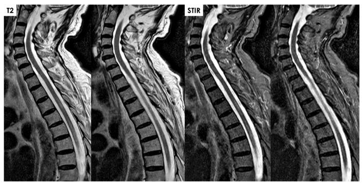 https://cdn.ncbi.nlm.nih.gov/pmc/blobs/4838/11856212/6b02cdcd7b84/jcm-14-01293-g008.jpg