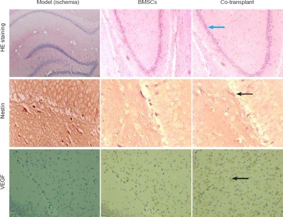 https://cdn.ncbi.nlm.nih.gov/pmc/blobs/483f/4625507/4b8f4de3ba9b/NRR-10-1421-g004.jpg
