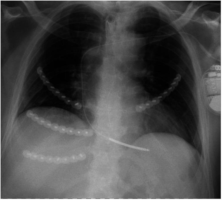 https://cdn.ncbi.nlm.nih.gov/pmc/blobs/4844/9899886/8809252f6cfe/fsurg-10-1120399-g001.jpg