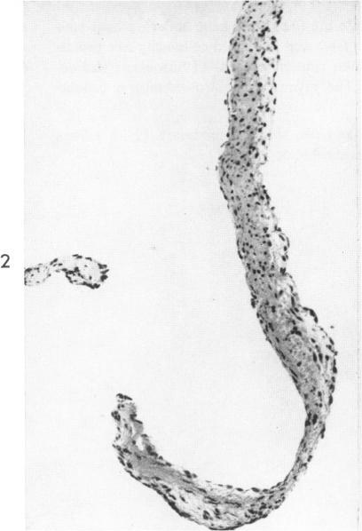 https://cdn.ncbi.nlm.nih.gov/pmc/blobs/4847/1942195/2794de02ff6c/amjpathol00351-0074-b.jpg