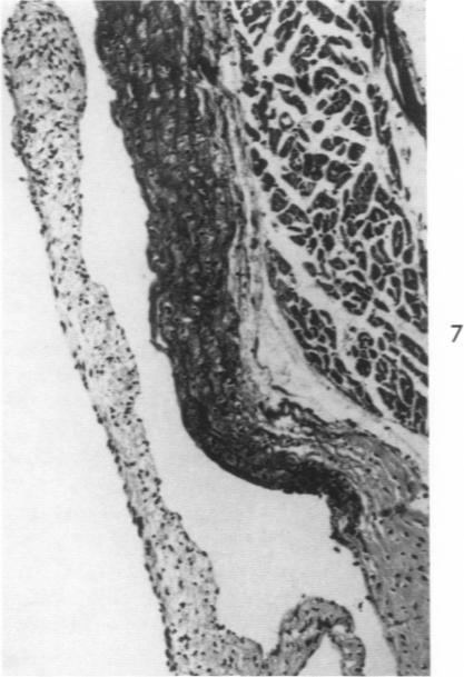 https://cdn.ncbi.nlm.nih.gov/pmc/blobs/4847/1942195/4efdc250b095/amjpathol00351-0076-d.jpg