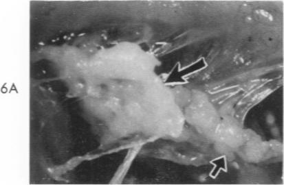 https://cdn.ncbi.nlm.nih.gov/pmc/blobs/4847/1942195/5fba366dc8b2/amjpathol00351-0076-b.jpg