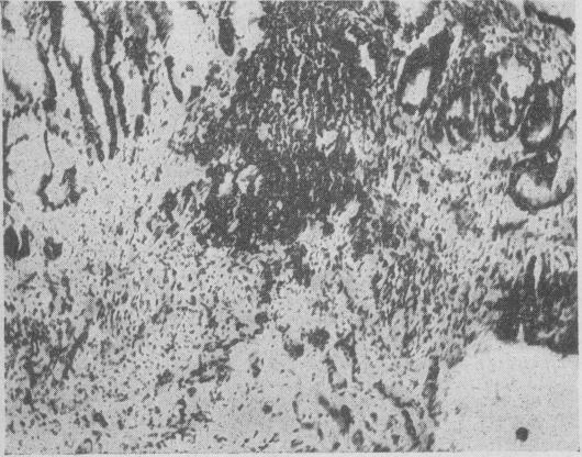https://cdn.ncbi.nlm.nih.gov/pmc/blobs/484d/1844002/bb7736afb298/brmedj02548-0040-a.jpg