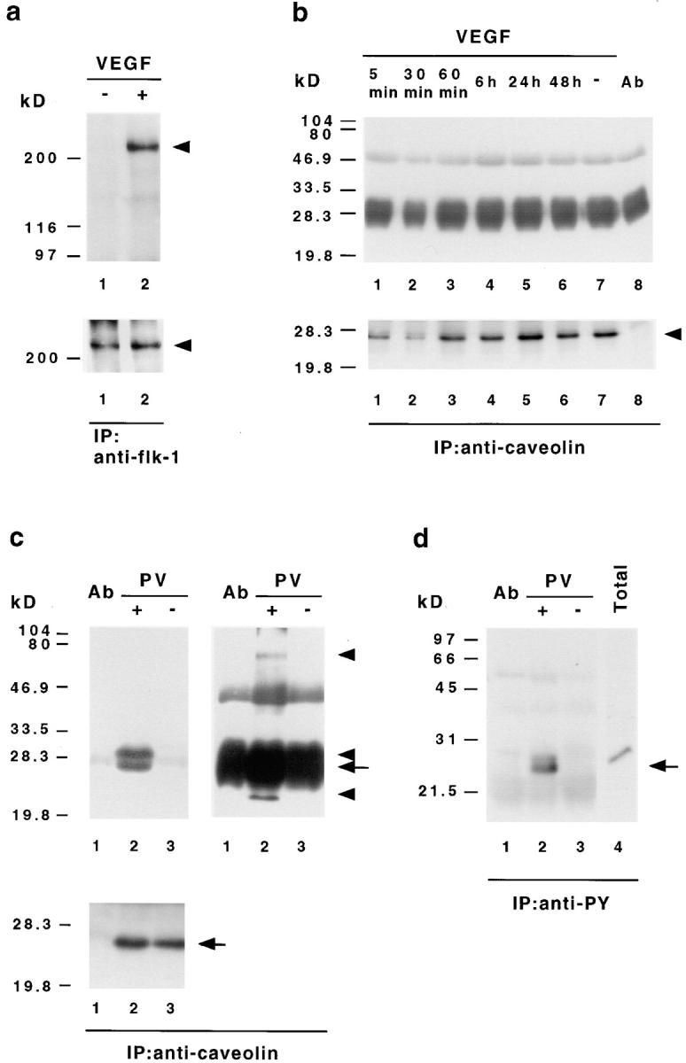 https://cdn.ncbi.nlm.nih.gov/pmc/blobs/4852/2141756/7b3d5db5672e/JCB15089.f6.jpg