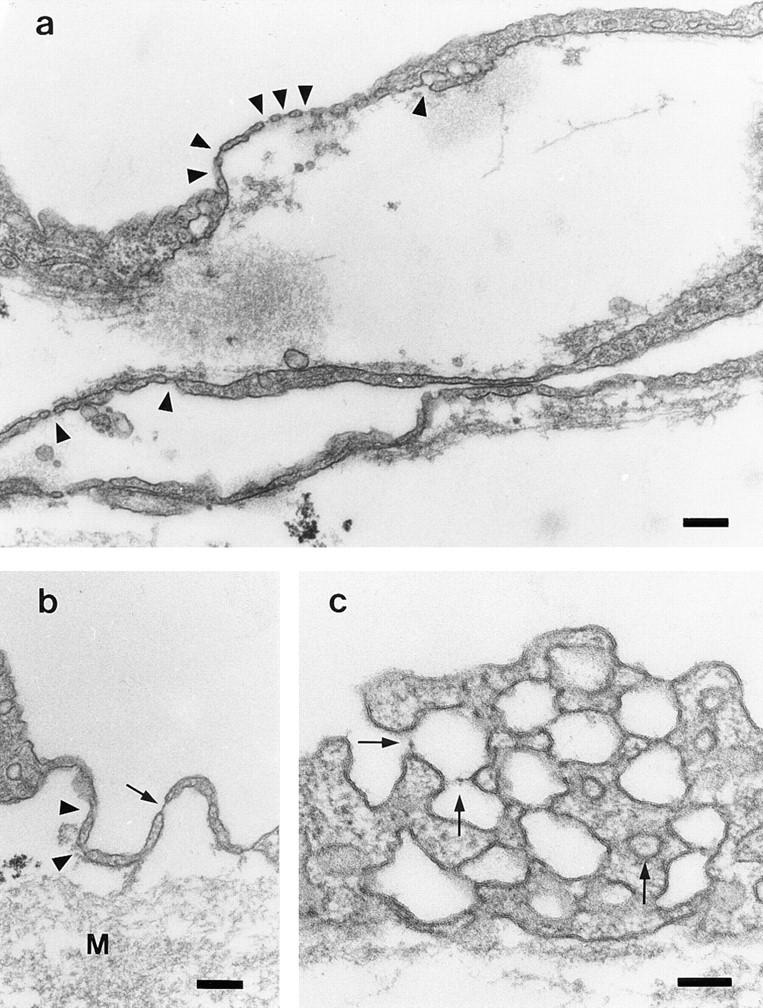 https://cdn.ncbi.nlm.nih.gov/pmc/blobs/4852/2141756/e776db9e031f/JCB15089.f4.jpg