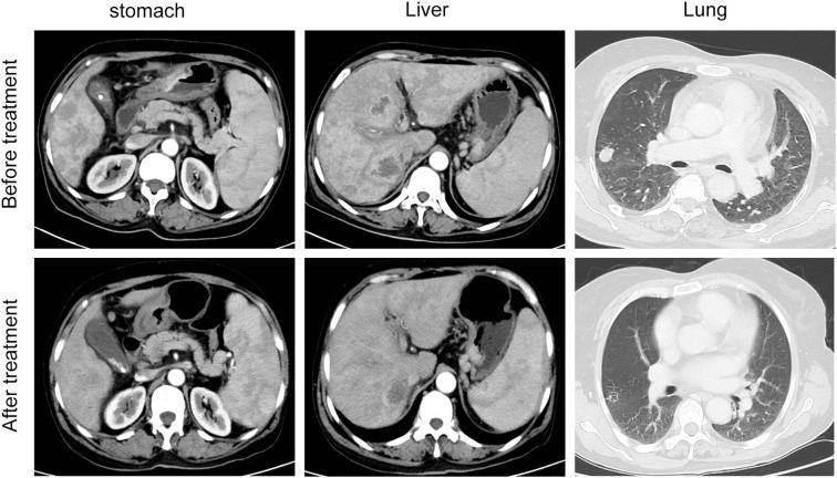 https://cdn.ncbi.nlm.nih.gov/pmc/blobs/4853/12074971/b4551ec052f9/fonc-15-1587069-g002.jpg