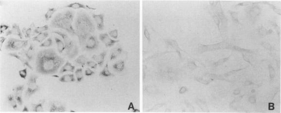 https://cdn.ncbi.nlm.nih.gov/pmc/blobs/4855/1886532/adf8a50d32a1/amjpathol00089-0179-a.jpg