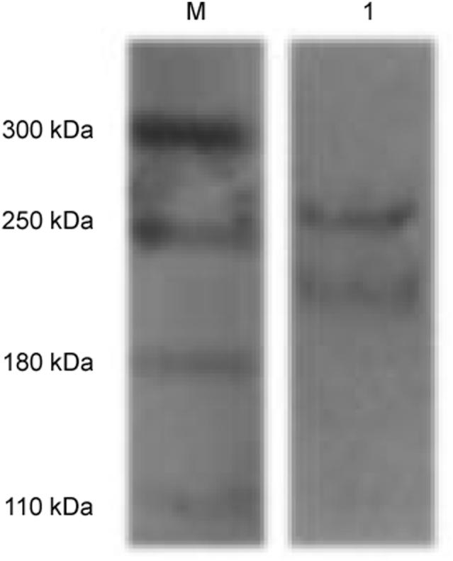 https://cdn.ncbi.nlm.nih.gov/pmc/blobs/4856/5790689/708690bdba56/gr7.jpg