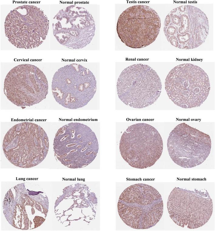 https://cdn.ncbi.nlm.nih.gov/pmc/blobs/4860/9846156/4df5bd92532a/fgene-13-1024989-g002.jpg