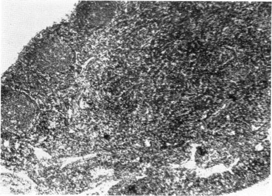 https://cdn.ncbi.nlm.nih.gov/pmc/blobs/486b/1712737/444c3ccab822/clinexpimmunol00382-0017-a.jpg