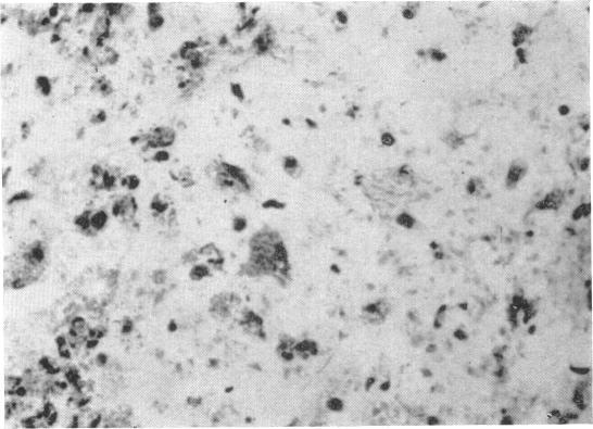 https://cdn.ncbi.nlm.nih.gov/pmc/blobs/486b/1712737/4b567eff0028/clinexpimmunol00382-0015-b.jpg