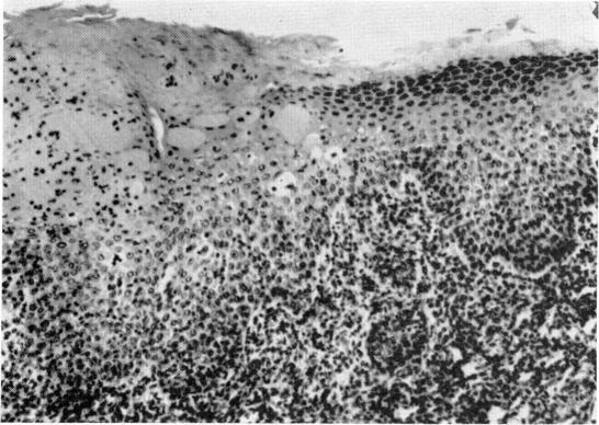 https://cdn.ncbi.nlm.nih.gov/pmc/blobs/486b/1712737/57a1a5554cc2/clinexpimmunol00382-0014-a.jpg